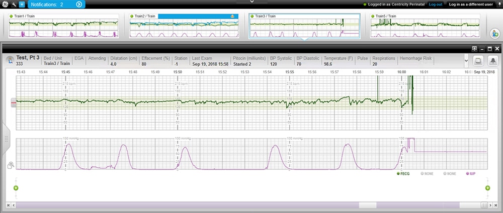 Centricity Perinatal Connect Module