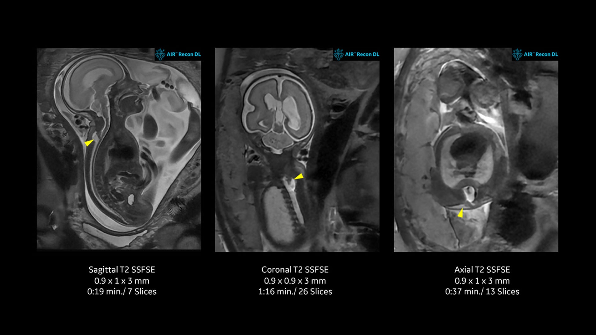 Product Media Carousel Image