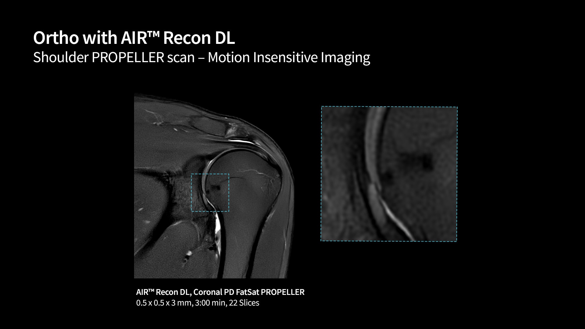Product Media Carousel Image