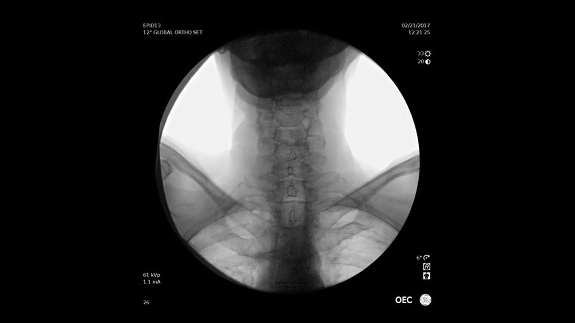 Product Media Carousel Image