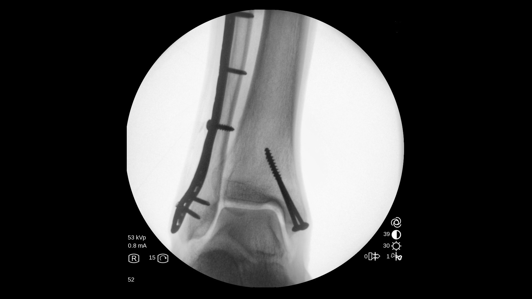 Product Media Carousel Image