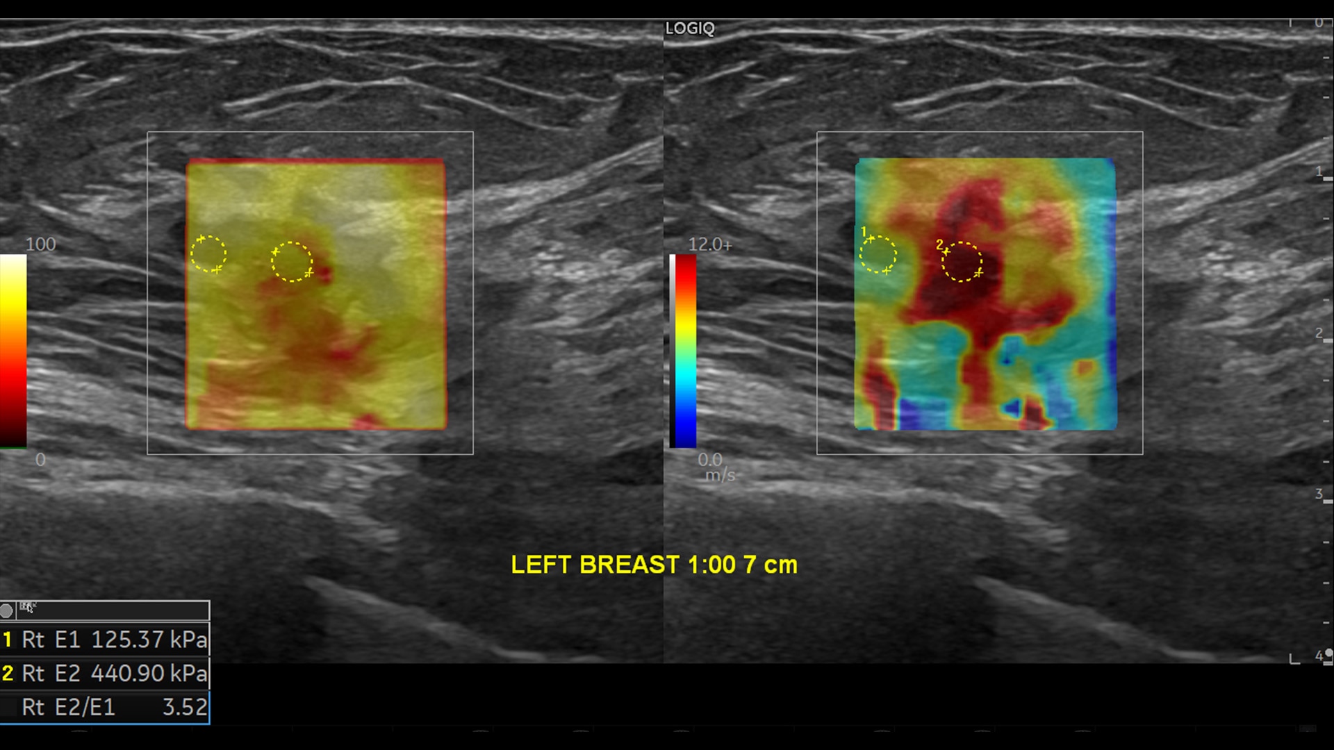 Product Media Carousel Image