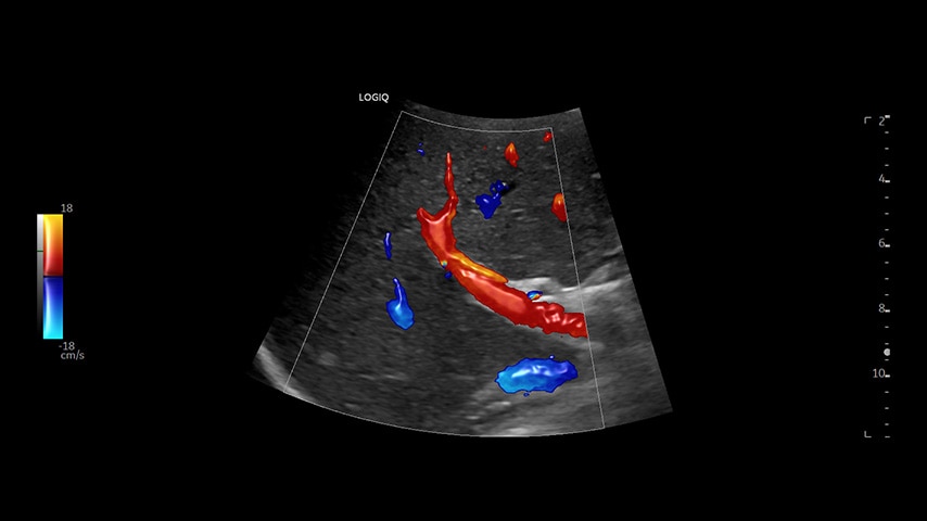 Product Media Carousel Image