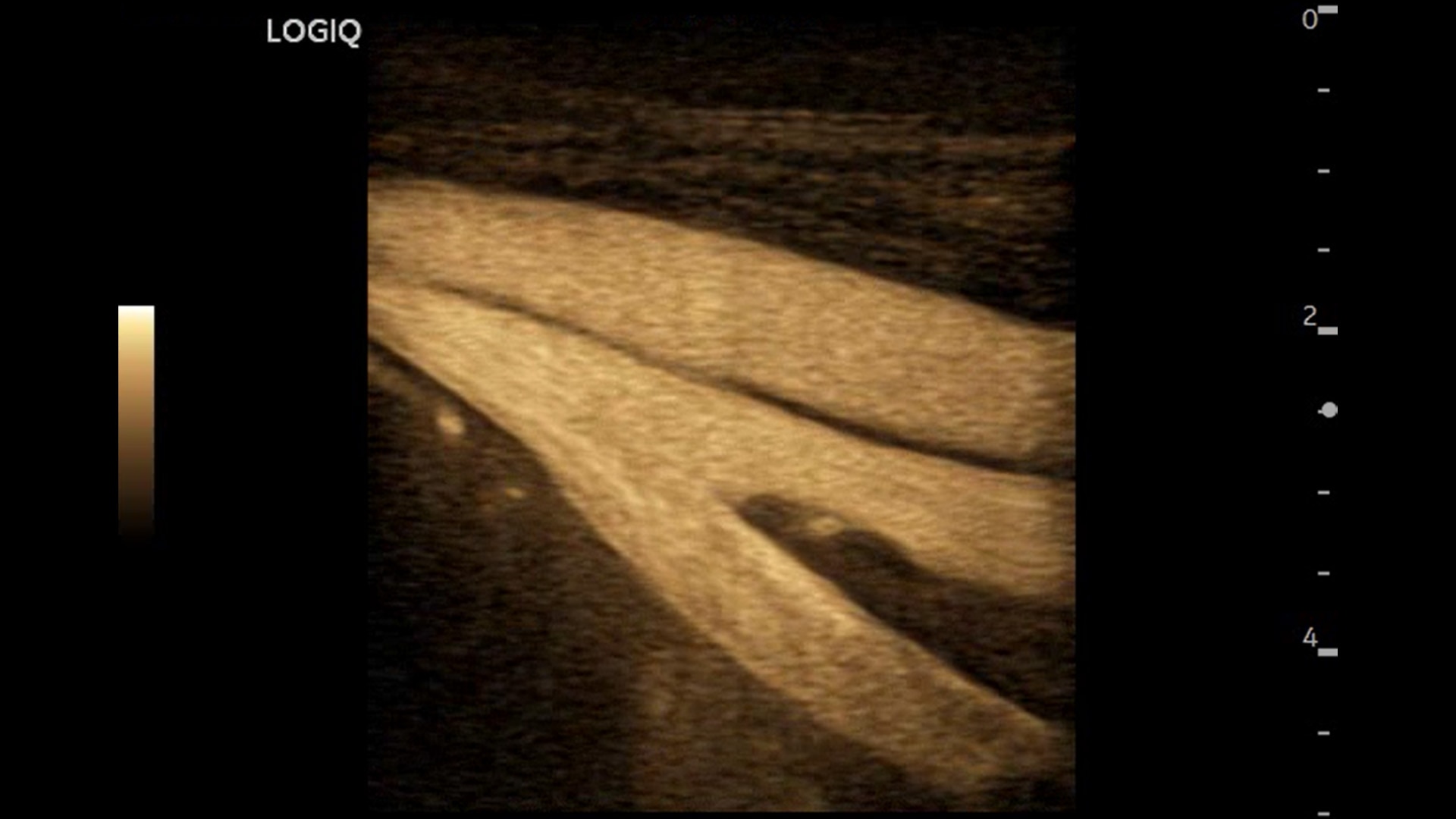 Product Media Carousel Image