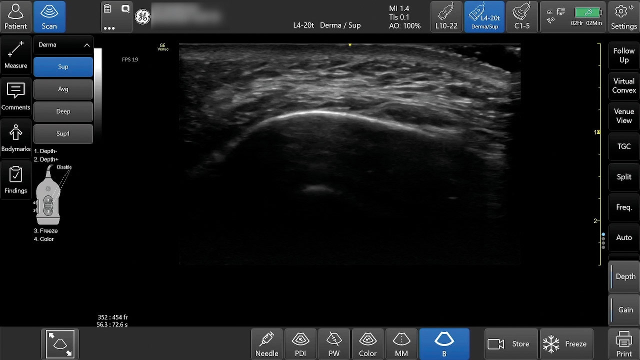 Product Media Carousel Image