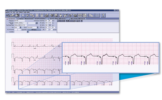 ecg cardio muse