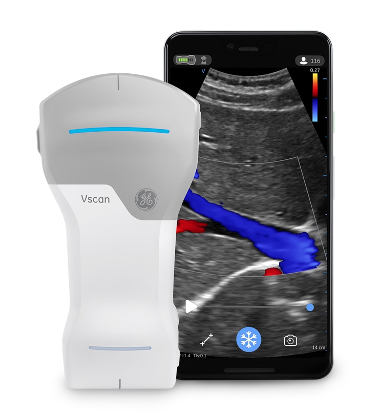 VscanAir_01