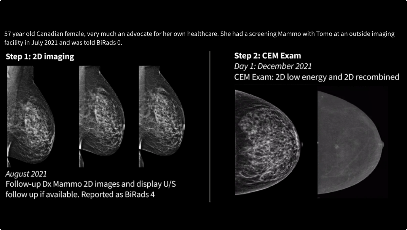 Product Media Carousel Image