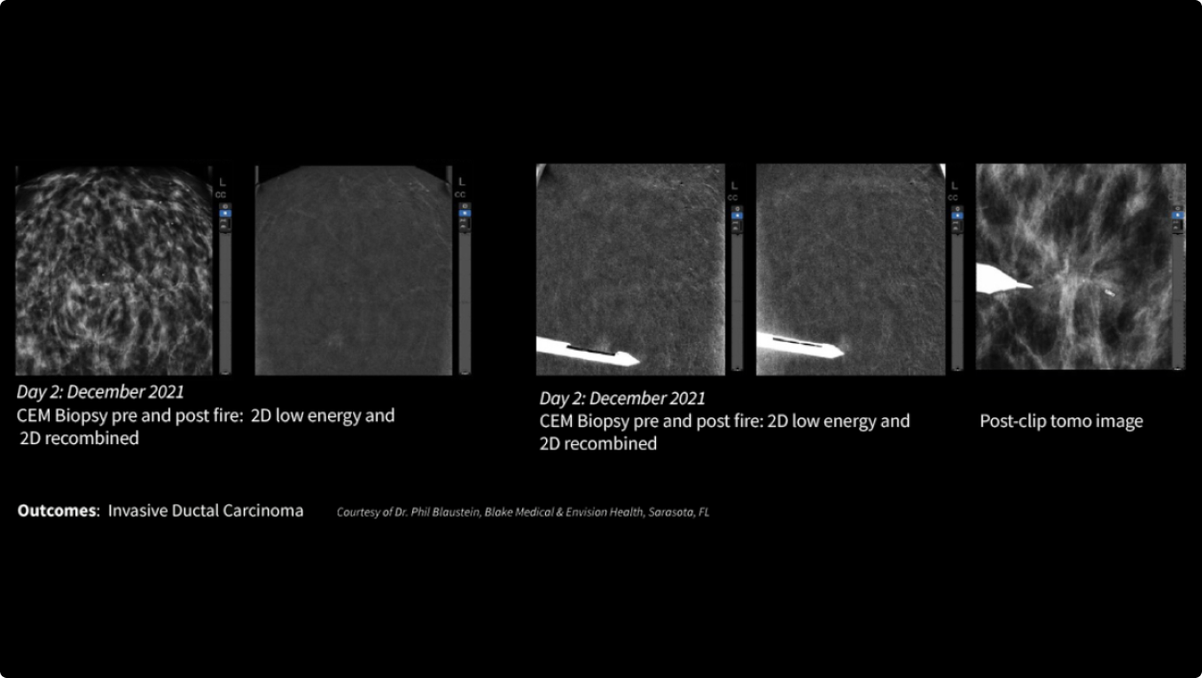 Product Media Carousel Image