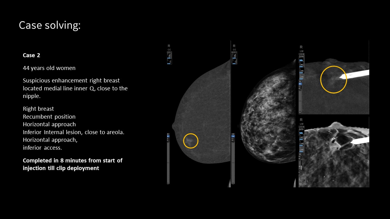 Product Media Carousel Image