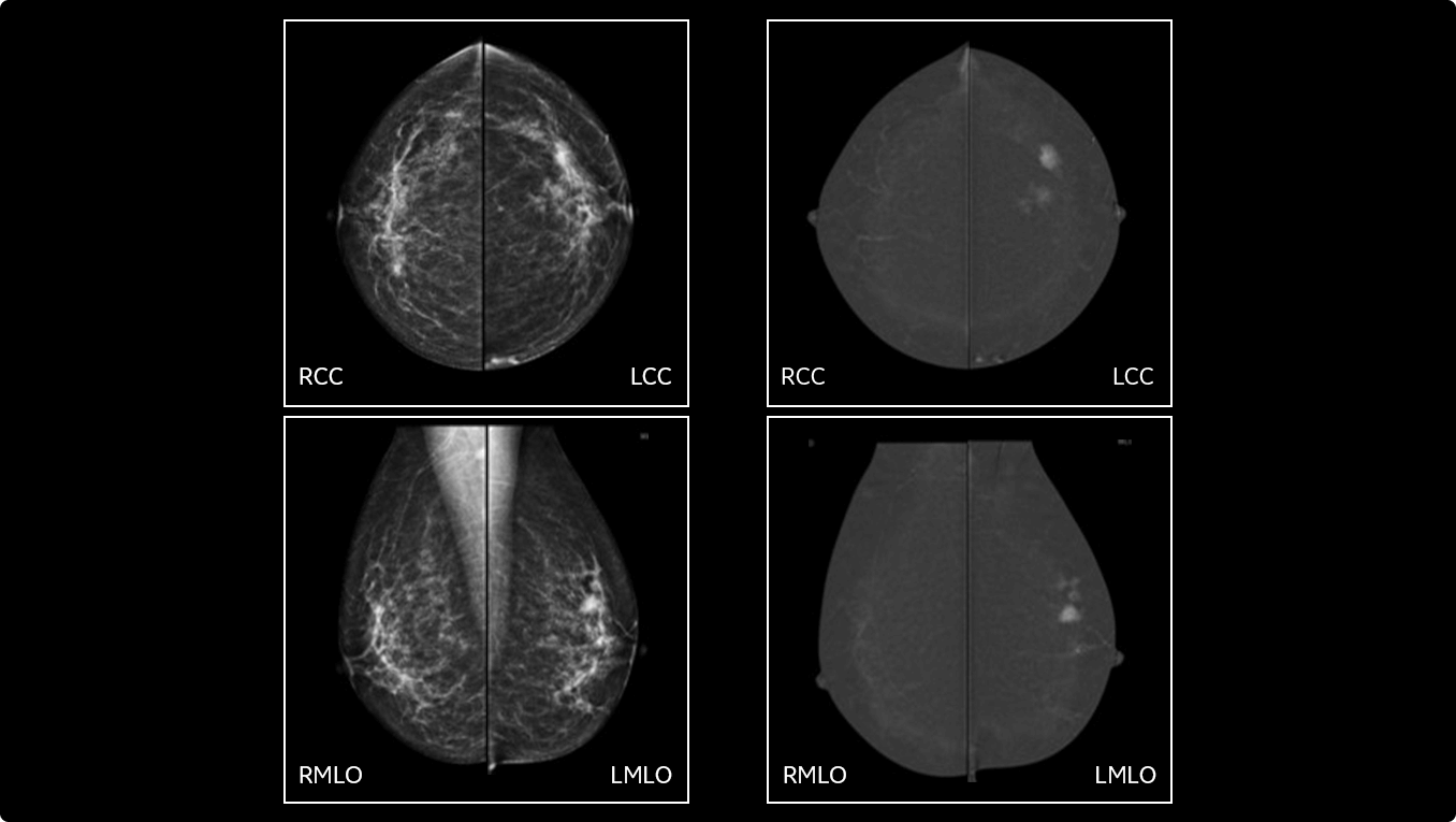 Product Media Carousel Image