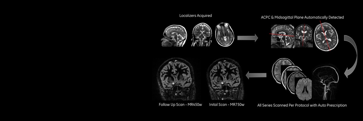 neuro imaging t2 propeller sagittal