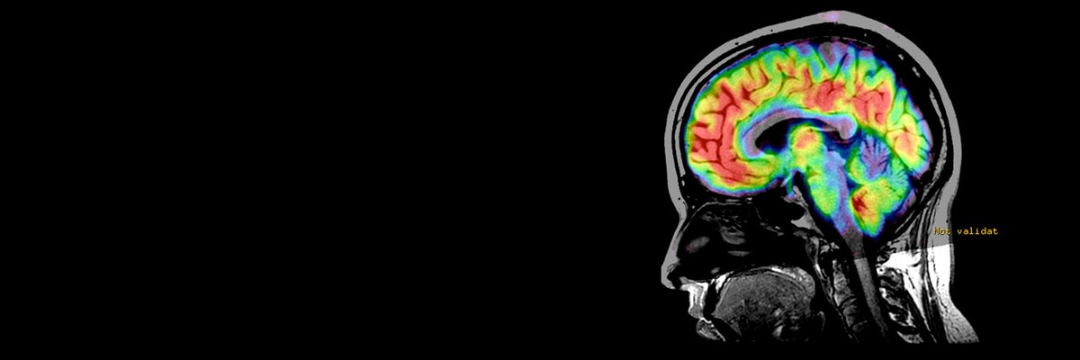 3D ASL pediatric imaging clinical head