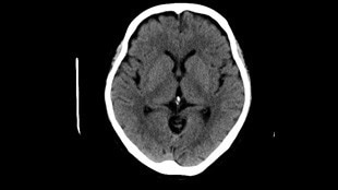 Low dose routine head clinical image