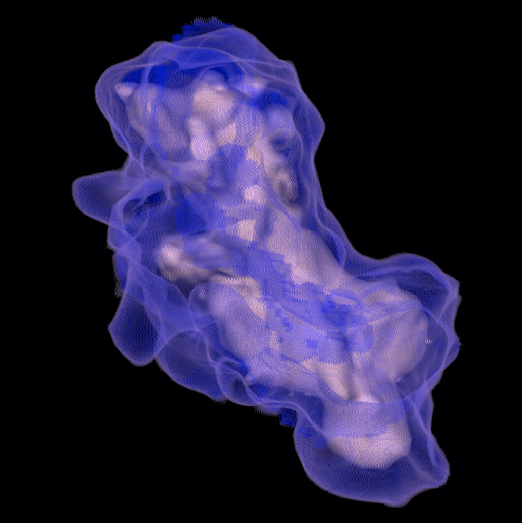 advanced visualization lung vcar.