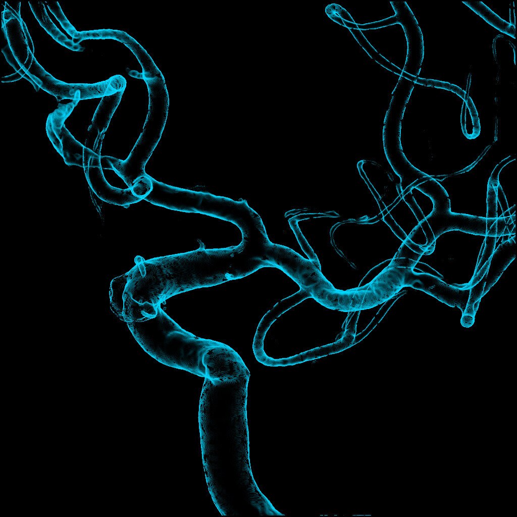GE Healthcare Innova IGS 540 Clinical Application Innova 3D