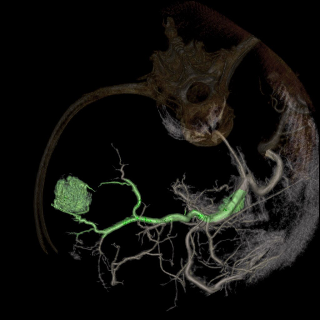 GE Healthcare Innova IGS 540 Clinical Application FlightPlan for Liver