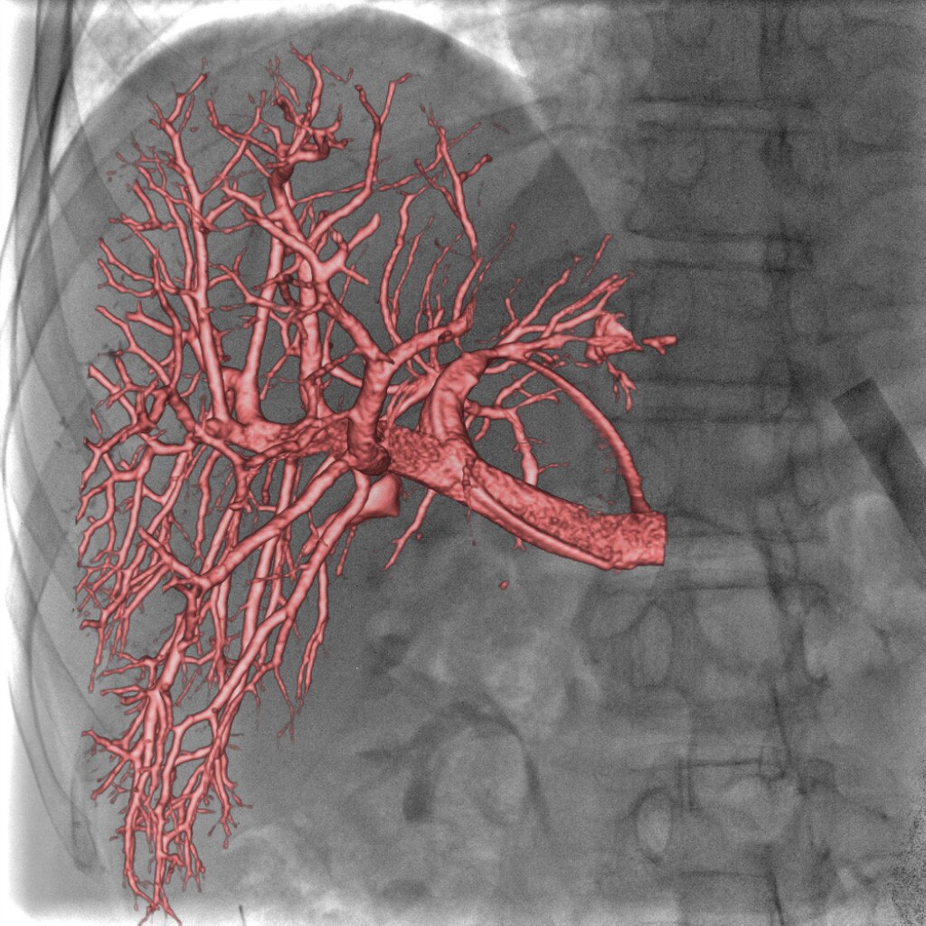 GE Healthcare Innova IGS 540 Clinical Application Innova Vision