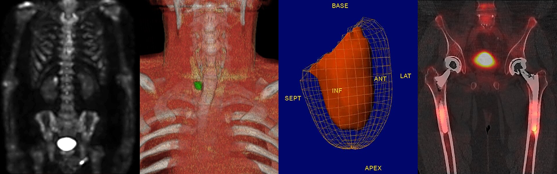 theranostics_1920x600_with-Lu177_Flat_Animated-gif-file_REVISED_5_13_21