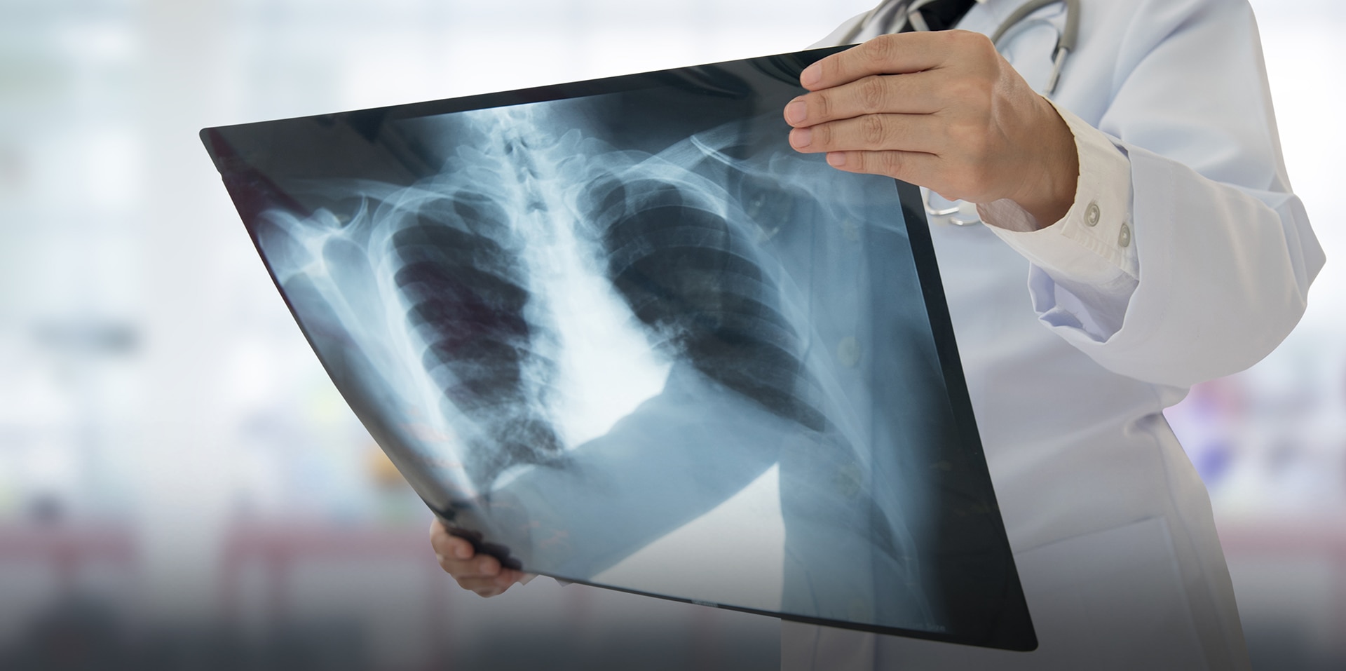 A radiologist reads patient X-ray and makes well informed decisions.