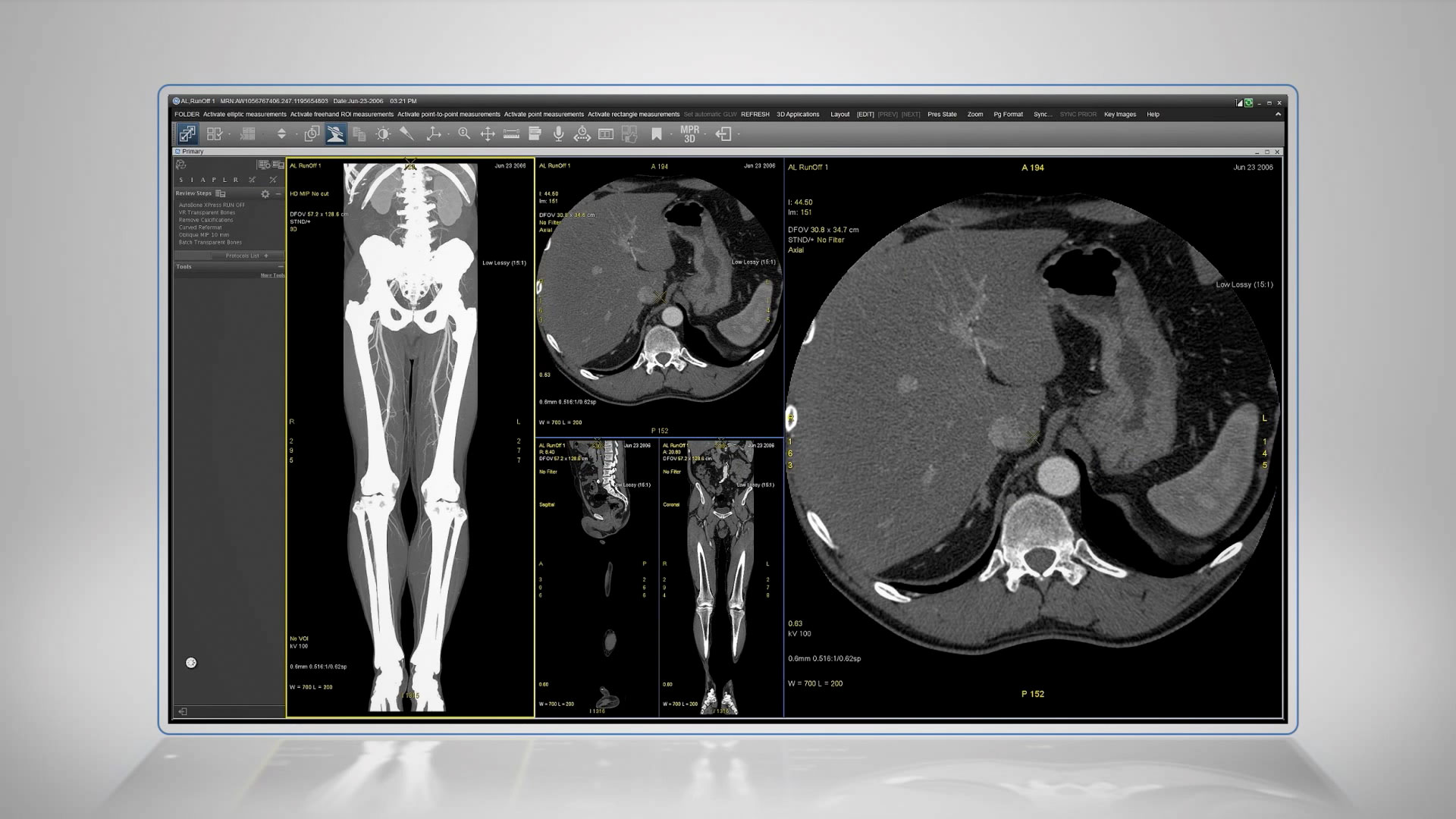 Universal-Viewer-Autobone-Xpress-Demo