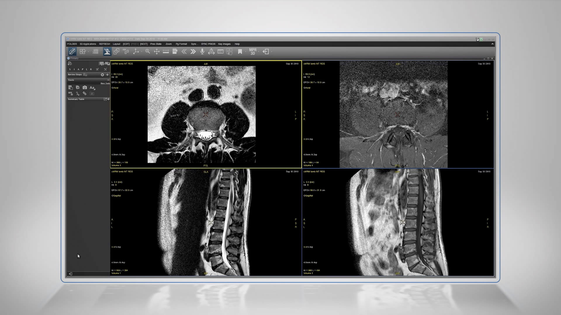 Universal-Viewer-Integrated-Registration-Demo