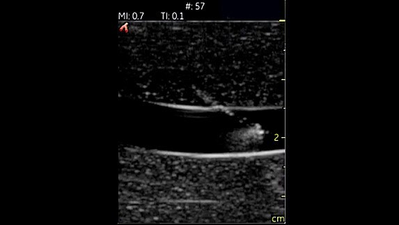 hotspot tours-vscan-vascular-procedure-guidance_jpg