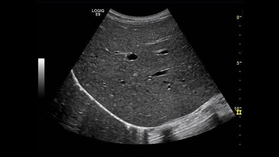 hotspot tours-logiq e9-coded-harmonic-imaging_jpg