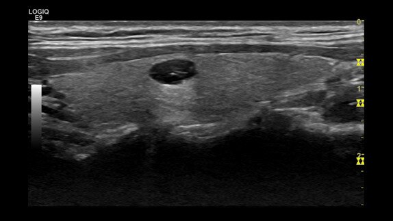 hotspot tours-logiq e9-auto-optimization_jpg