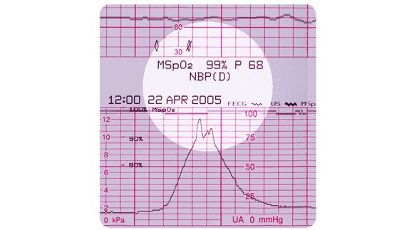 hotspot tours-mic-corometrics 250cx-gehc-corometrics-250cx_hotspot_5_jpg