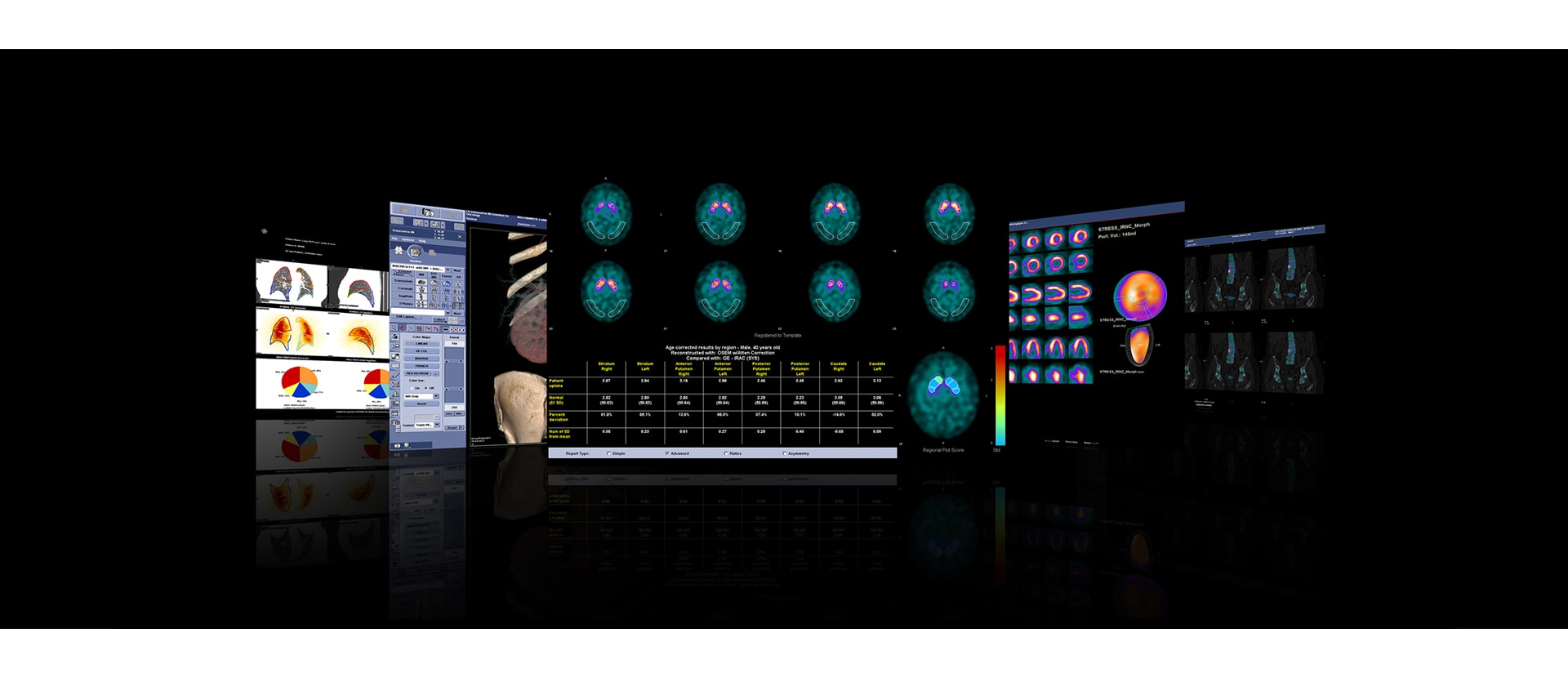 GEHCXeleris4DRAdditionalApplicationsImage1v1