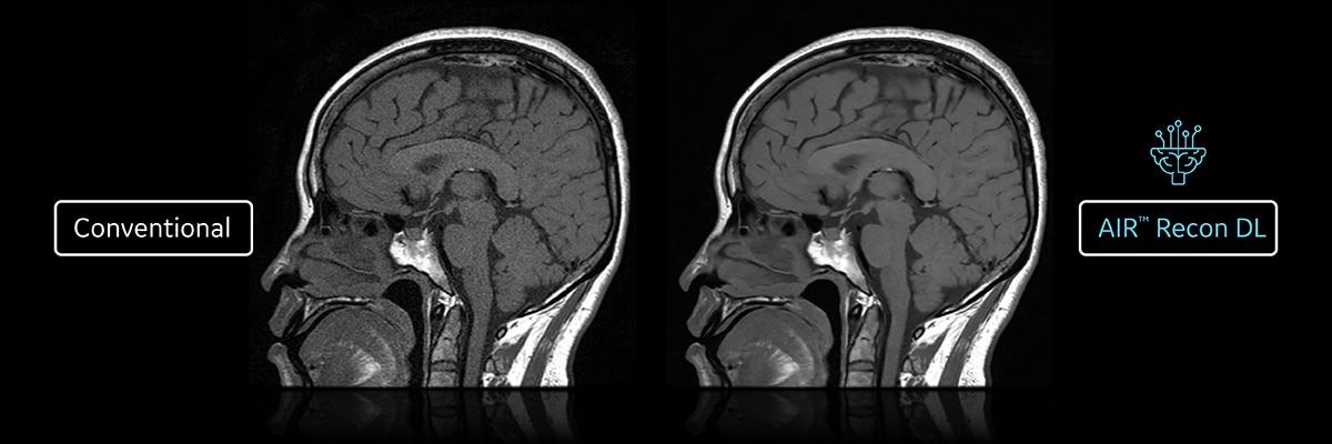 GEHCSIGNAPrimePWPEasyToReadImage5