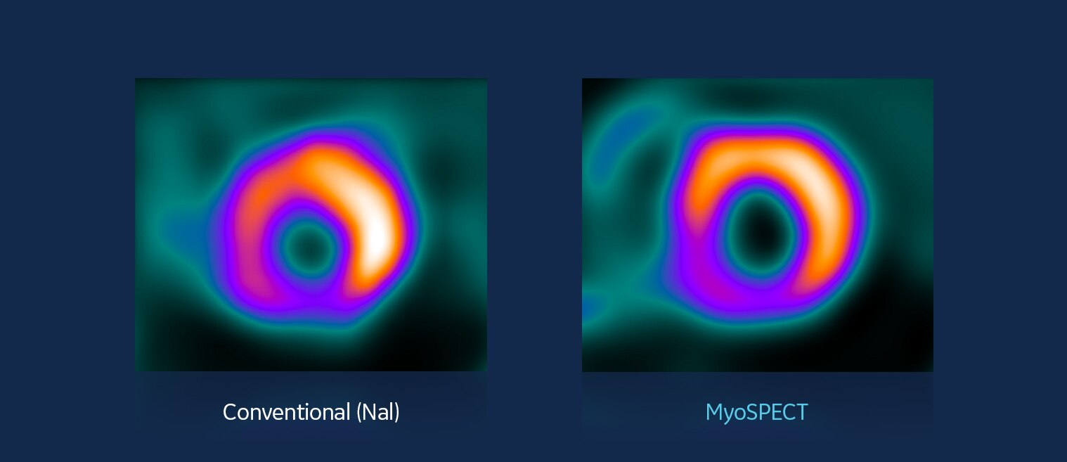 GEHC MyoSPECT PWP Image Quality Image 1 v2