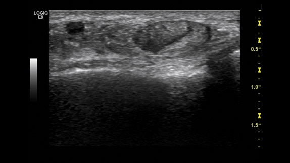 hotspot tours-logiq e9-cross-beam_jpg