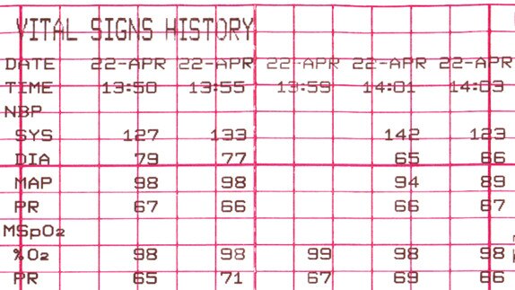 hotspottours-mic-corometrics250cx-gehc-corometrics-250cx-hotspot-4
