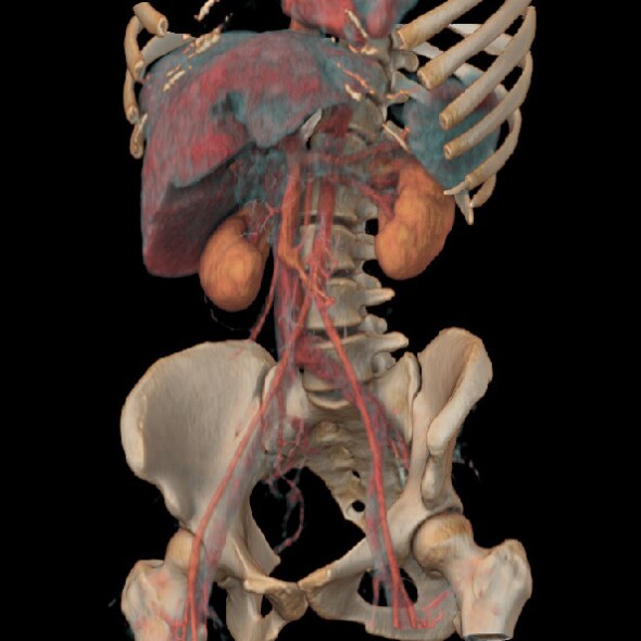 GE Healthcare RSNA 2021