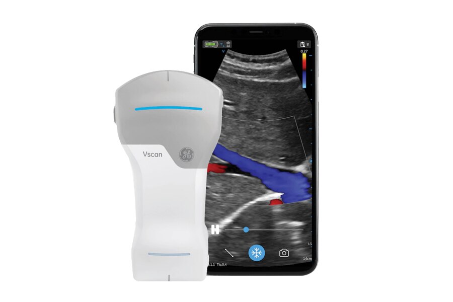 GE Healthcare Vscan ハンディスキャナー GE-Healthcare-V-Scan-Single-