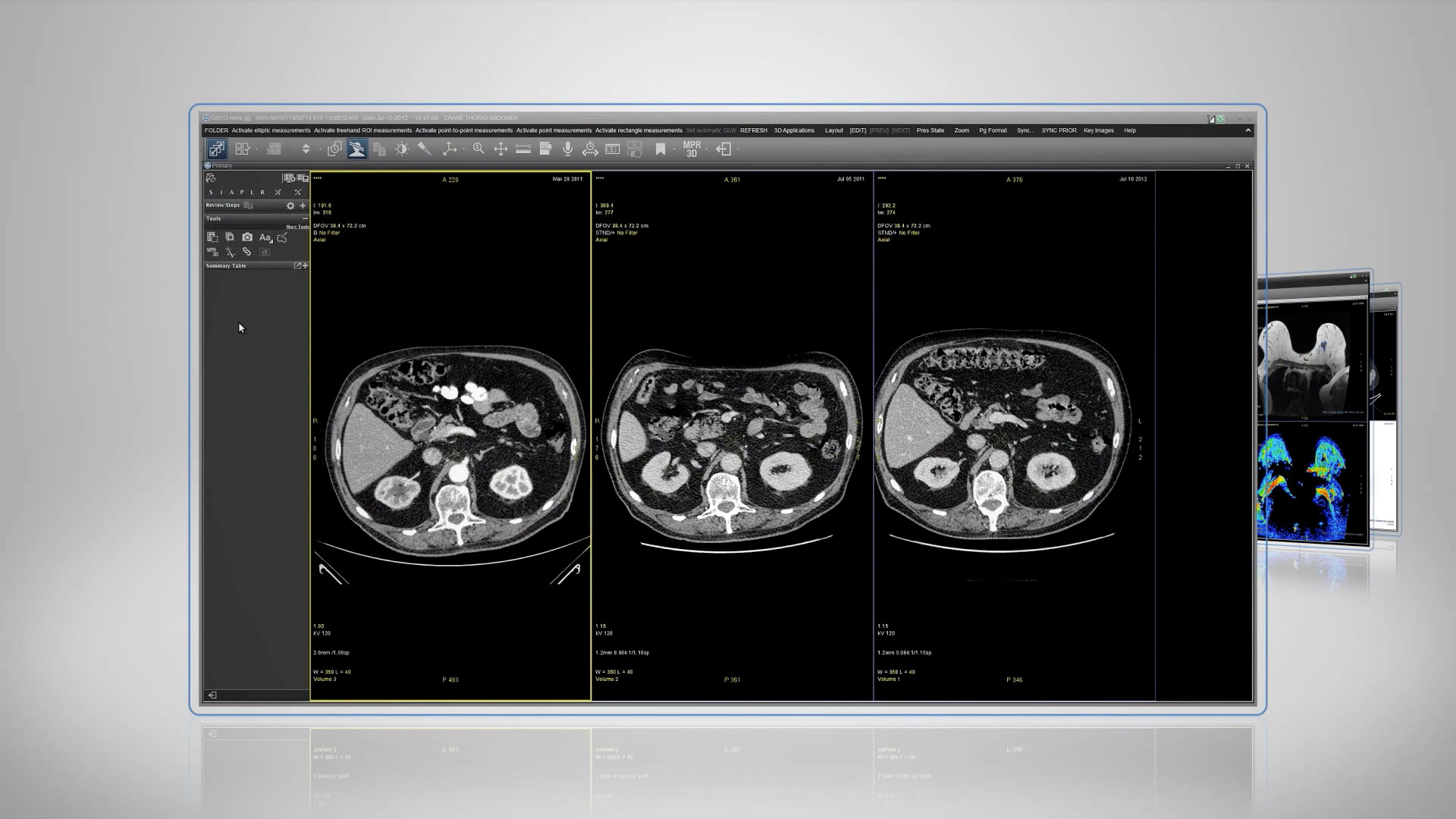 Universal-Viewer-OncoQuant-Demo