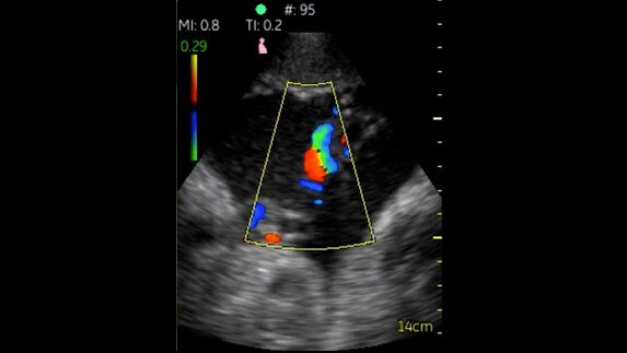 hotspot tours-vscan-umbilical-cord-with-color-flow_jpg