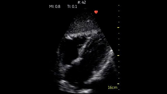 hotspot tours-vscan-cardiac-subcostal_jpg