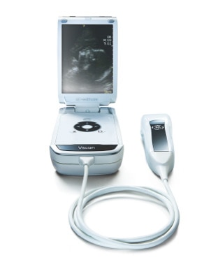 GE Healthcare Vscan ハンディスキャナー GE Healthcare Vscan ハンディスキャナー Vscan Pocket-Sized