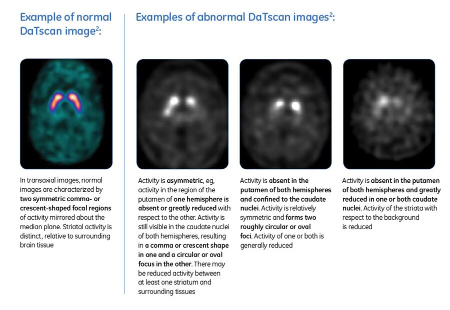 DaTscan GE HealthCare (Singapore)