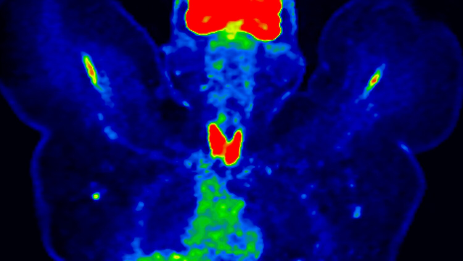 product-product-categories-pet-ct-qclear-gehc-qclear-case-1_thumbnail.jpg