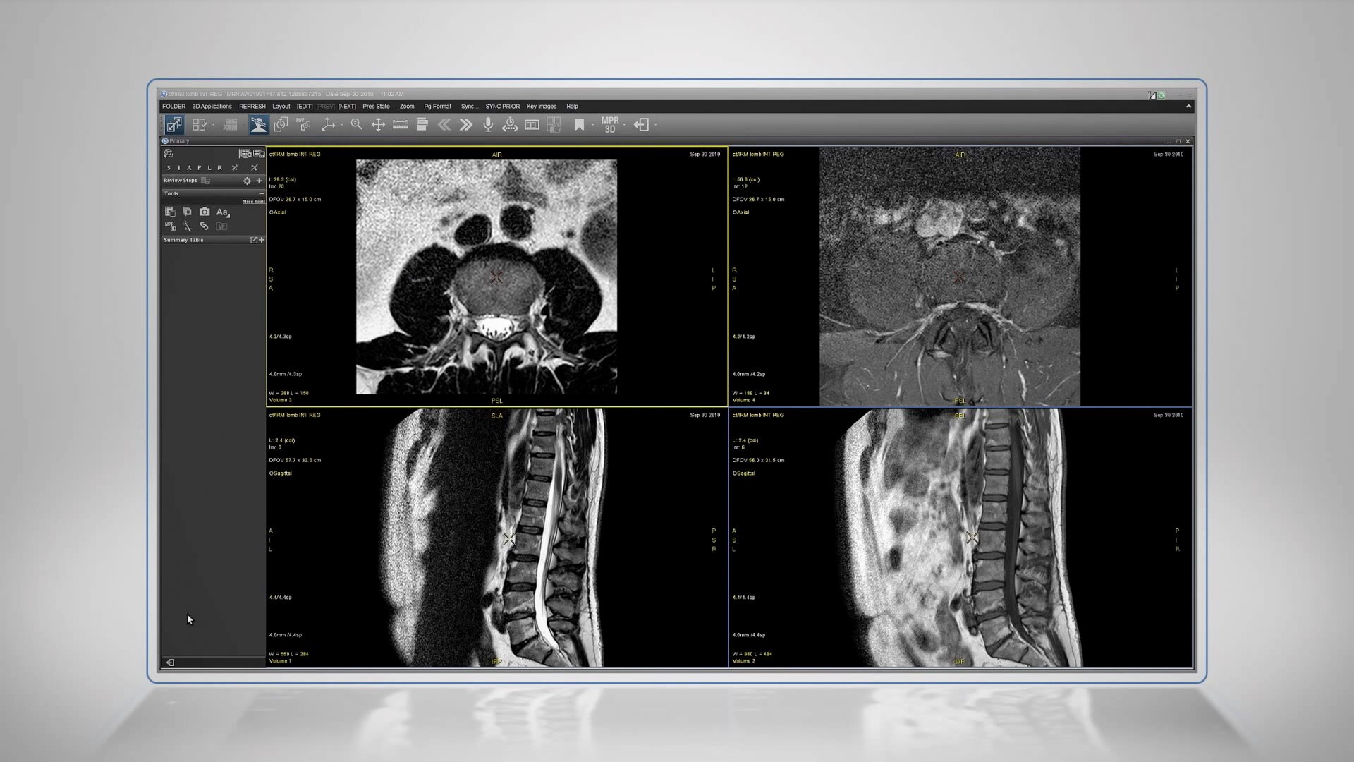 Universal-Viewer-Integrated-Registration-Demo