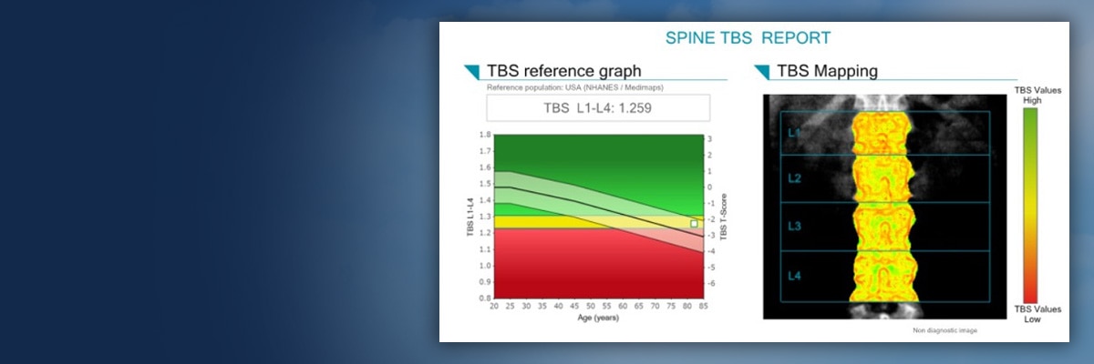 Trabecular Bone Score | GE HealthCare (Thailand)