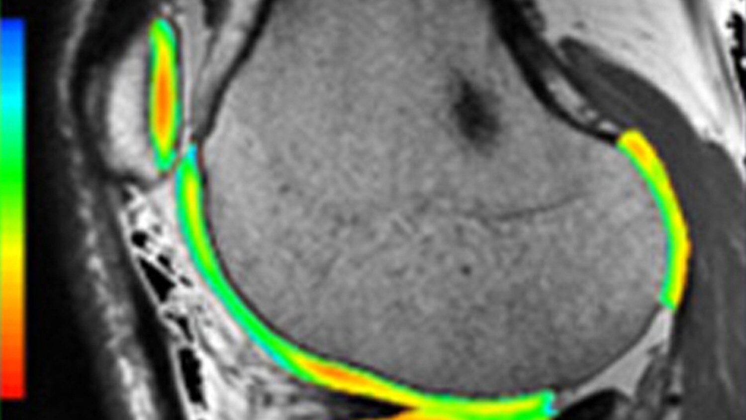Vascular Advanced Visualization | GE Healthcare (Thailand)