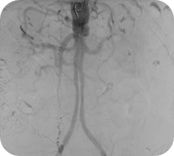 product-product-categories-Intervantional - 2016-vessel_13.jpg