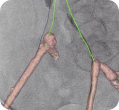 product-product-categories-Intervantional - 2016-vessel_12.jpg