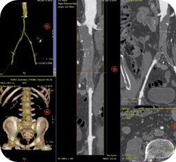 product-product-categories-Intervantional - 2016-vessel_11.jpg