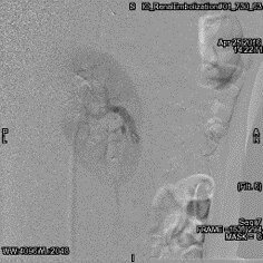 product-product-categories-Intervantional - 2016-vessel_13.jpg